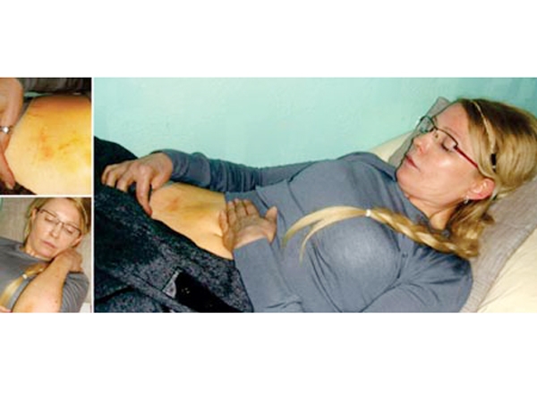 Những tấm ảnh bà Tymoshenko bị thương ở bụng và tay được hãng tin Reuters đăng tải.